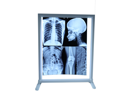 X射线胶片观片灯